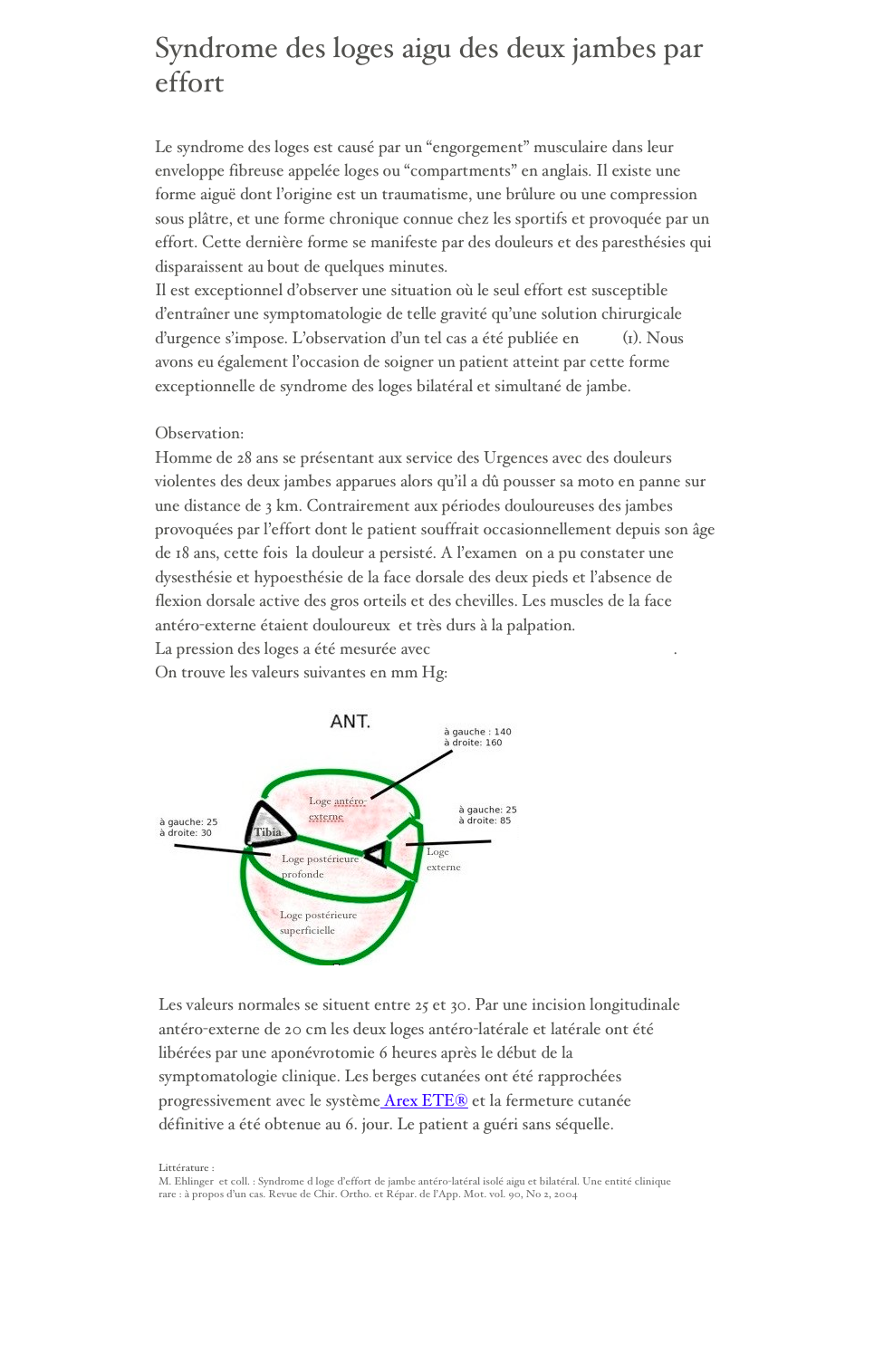 
Syndrome des loges aigu des deux jambes par 
effort

Le syndrome des loges est causé par un “engorgement” musculaire dans leur enveloppe fibreuse appelée loges ou “compartments” en anglais. Il existe une forme aiguë dont l’origine est un traumatisme, une brûlure ou une compression sous plâtre, et une forme chronique connue chez les sportifs et provoquée par un effort. Cette dernière forme se manifeste par des douleurs et des paresthésies qui disparaissent au bout de quelques minutes.
Il est exceptionnel d’observer une situation où le seul effort est susceptible d’entraîner une symptomatologie de telle gravité qu’une solution chirurgicale d’urgence s’impose. L’observation d’un tel cas a été publiée en 2004 (1). Nous avons eu également l’occasion de soigner un patient atteint par cette forme exceptionnelle de syndrome des loges bilatéral et simultané de jambe.

Observation:
Homme de 28 ans se présentant aux service des Urgences avec des douleurs violentes des deux jambes apparues alors qu’il a dû pousser sa moto en panne sur une distance de 3 km. Contrairement aux périodes douloureuses des jambes provoquées par l’effort dont le patient souffrait occasionnellement depuis son âge de 18 ans, cette fois  la douleur a persisté. A l’examen  on a pu constater une dysesthésie et hypoesthésie de la face dorsale des deux pieds et l’absence de flexion dorsale active des gros orteils et des chevilles. Les muscles de la face antéro-externe étaient douloureux  et très durs à la palpation.
La pression des loges a été mesurée avec l’instrument de laboratoire Stryker.
On trouve les valeurs suivantes en mm Hg:

￼

￼
